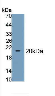 Polyclonal Antibody to Glucose Transporter 1 (GLUT1)