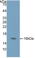 Polyclonal Antibody to Pro-Gastrin Releasing Peptide (ProGRP)