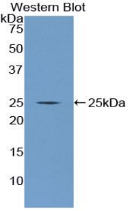 Polyclonal Antibody to Nucleoporin 160 (NUP160)