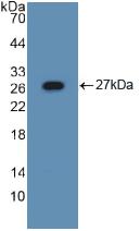 Polyclonal Antibody to Asialoglycoprotein Receptor 1 (ASGR1)