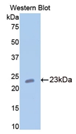 Polyclonal Antibody to Cartilage Oligomeric Matrix Protein (COMP)