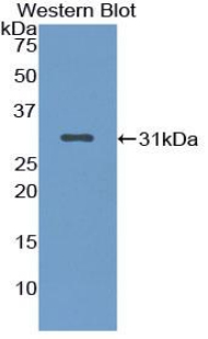 Polyclonal Antibody to Nucleoporin 88 (NUP88)