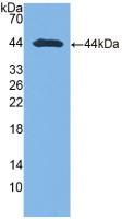 Polyclonal Antibody to Aspartate Aminotransferase (AST)