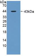 Polyclonal Antibody to Aspartate Aminotransferase (AST)