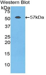 Polyclonal Antibody to Fibrinogen Beta Chain (FGB)