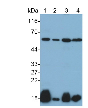 PAB222Hu01.jpg