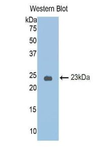 Polyclonal Antibody to Corticosteroid Binding Globulin (CBG)