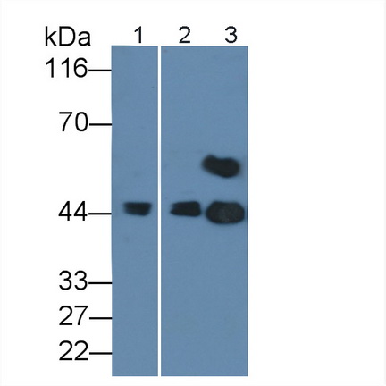 PAB226Hu05.jpg