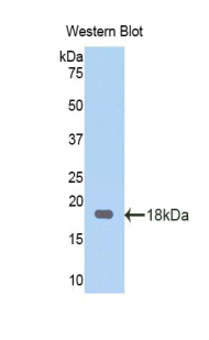 Polyclonal Antibody to Corticosteroid Binding Globulin (CBG)