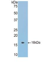 Polyclonal Antibody to Corticosteroid Binding Globulin (CBG)