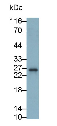 Polyclonal Antibody to Cytotoxic T-Lymphocyte Associated Antigen 4 (CTLA4)