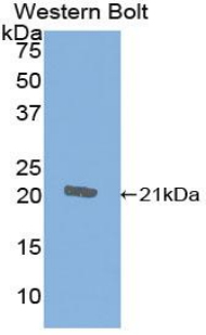 Polyclonal Antibody to Cytotoxic T-Lymphocyte Associated Antigen 4 (CTLA4)