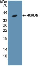 Polyclonal Antibody to Cytokeratin 18 (CK18)