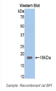 Polyclonal Antibody to Bactericidal/Permeability Increasing Protein (BPI)