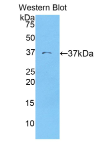 Polyclonal Antibody to Cytokeratin 19 (CK19)