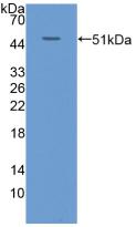 Polyclonal Antibody to Cytokeratin 20 (CK 20)