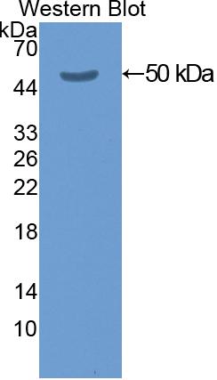 Polyclonal Antibody to Cytokeratin 20 (CK 20)