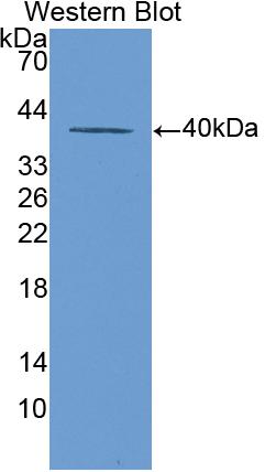 Polyclonal Antibody to Cytokeratin 20 (CK 20)