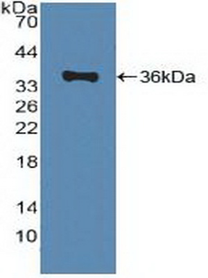 Polyclonal Antibody to ATP Binding Cassette Transporter A1 (ABCA1)