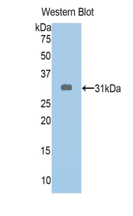 Polyclonal Antibody to ATP Binding Cassette Transporter A1 (ABCA1)