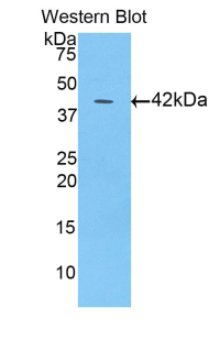 Polyclonal Antibody to Heart-type Fatty Acid Binding Protein (H-FABP)