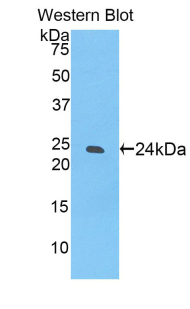 Polyclonal Antibody to Sialic Acid Binding Ig Like Lectin 12 (SIGLEC12)