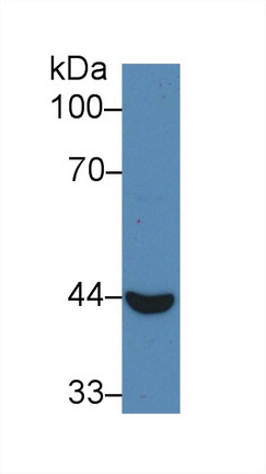 Polyclonal Antibody to Cytokeratin Fragment Antigen 21-1 (CYFRA21-1)