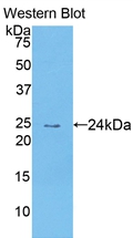 Polyclonal Antibody to Thymus Expressed Chemokine (TECK)