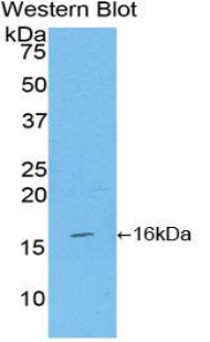 Polyclonal Antibody to Tumor Necrosis Factor Ligand Superfamily, Member 7 (TNFSF7)