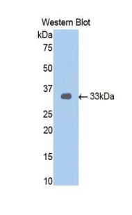 Polyclonal Antibody to Androgen Receptor (AR)