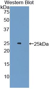 Polyclonal Antibody to Androgen Receptor (AR)