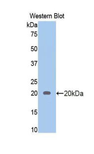 Polyclonal Antibody to Androgen Receptor (AR)