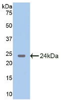 Polyclonal Antibody to Glutamate Decarboxylase 2 (GAD2)