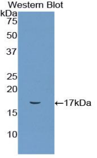 Polyclonal Antibody to Cluster Of Differentiation 72 (CD72)