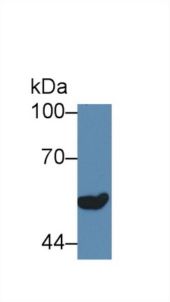 Polyclonal Antibody to Arginine Vasopressin Receptor 1B (AVPR1B)