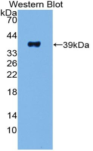 Polyclonal Antibody to Pancreatic Polypeptide (PP)