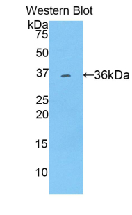 Polyclonal Antibody to Sulfotransferase 1A1 (SULT1A1)