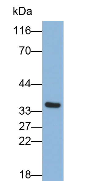 Polyclonal Antibody to Sulfotransferase 1A1 (SULT1A1)