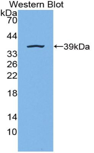 Polyclonal Antibody to ATP Dependent DNA ligase I (LIG1)