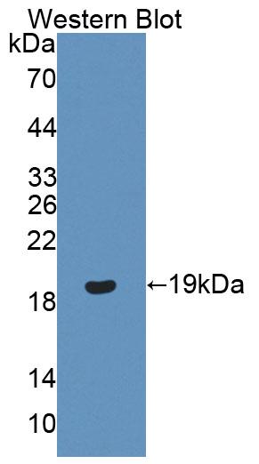 Polyclonal Antibody to Progesterone Receptor (PGR)