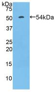 Polyclonal Antibody to Fc Fragment Of IgG Low Affinity IIIa Receptor (FcgR3A)