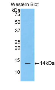 Polyclonal Antibody to Cathepsin D (CTSD)