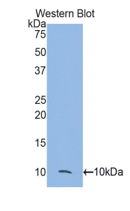 Polyclonal Antibody to Cathepsin D (CTSD)