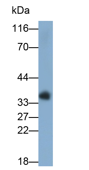 Polyclonal Antibody to Epithelial Cell Adhesion Molecule (EPCAM)