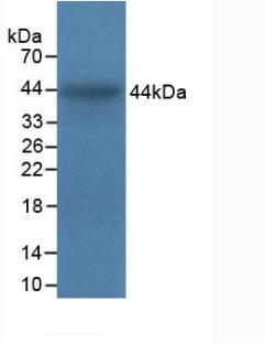 Polyclonal Antibody to Integrin Alpha 5 (ITGa5)