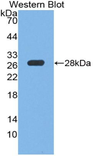 Polyclonal Antibody to Protein Tyrosine Phosphatase Receptor Type S (PTPRS)