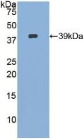 Polyclonal Antibody to Ezrin (EZR)