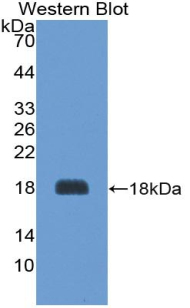 Polyclonal Antibody to Agouti Related Protein (AGRP)