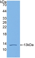 Polyclonal Antibody to Complement C4-B (C4B)