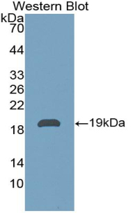 Polyclonal Antibody to Pleiotrophin (PTN)